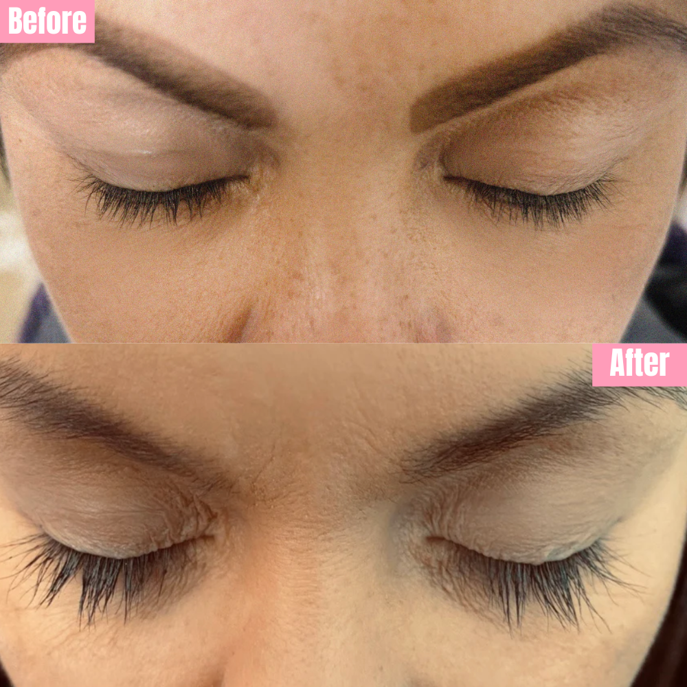Eyelash Growth Serum